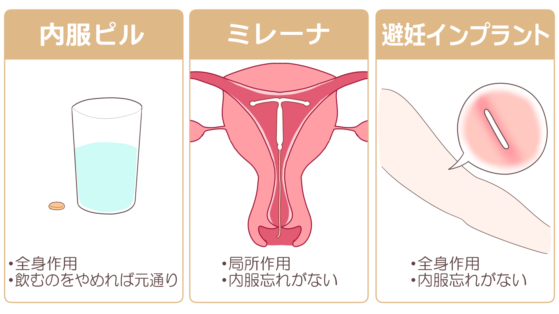implant20260713_007.png