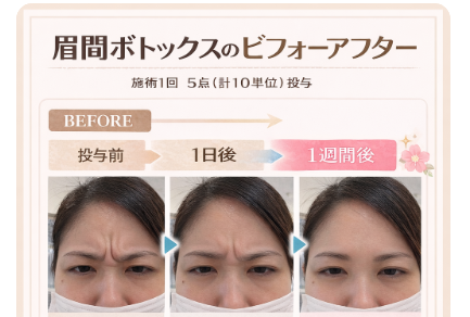 スクリーンショット 2026-02-21 110216.png