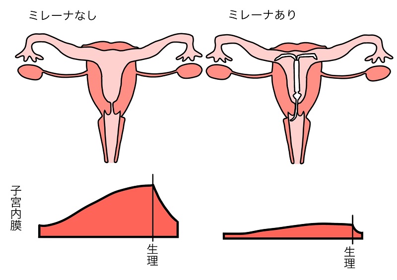 生理が来なくなる