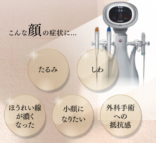 顔HIFU