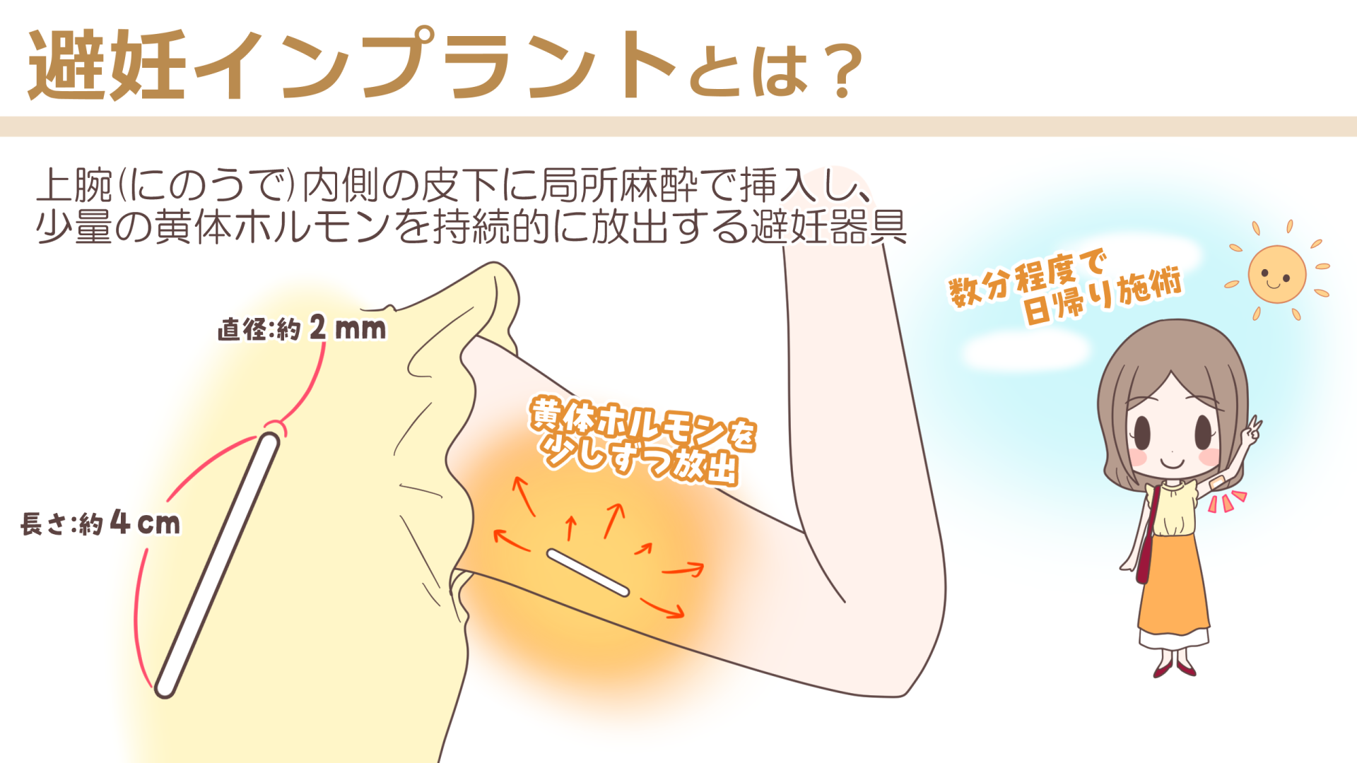 implant20260713_001.png